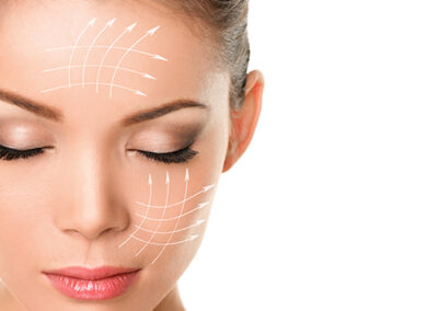 Skin Tightening